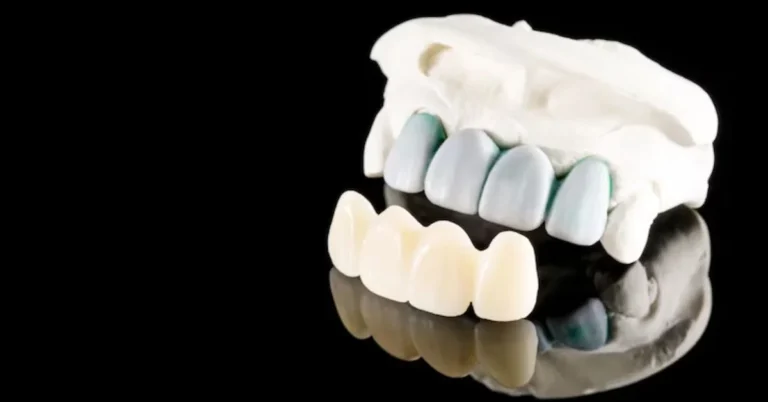 Zirconia Bridge